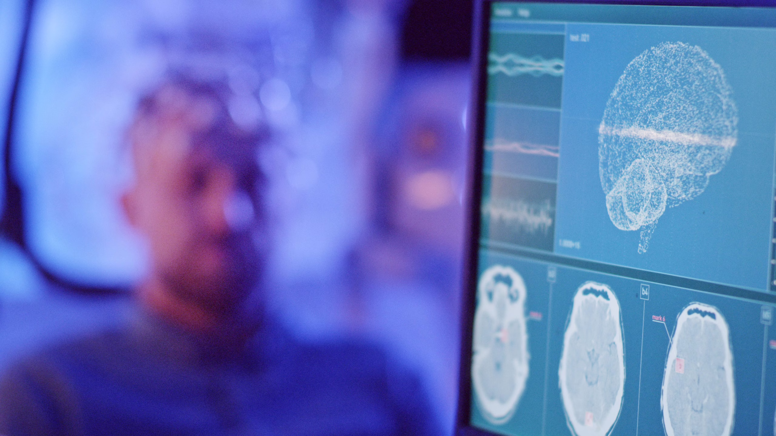 the-computer-that-runs-on-human-neurons
