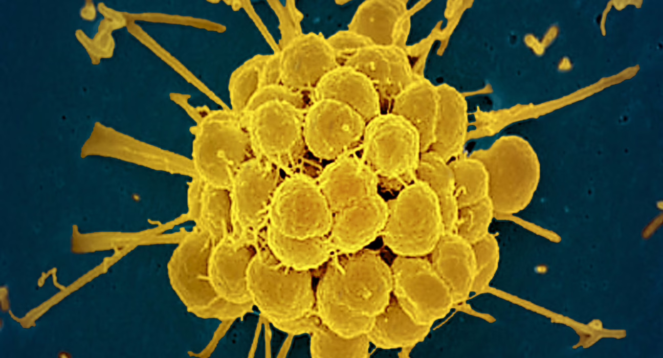 el-primer-antibiotico-descubierto-en-30-anos-llega-justo-a-tiempo-de-evitar-que-la-supergonorrea-sea-imposible-de-tratar