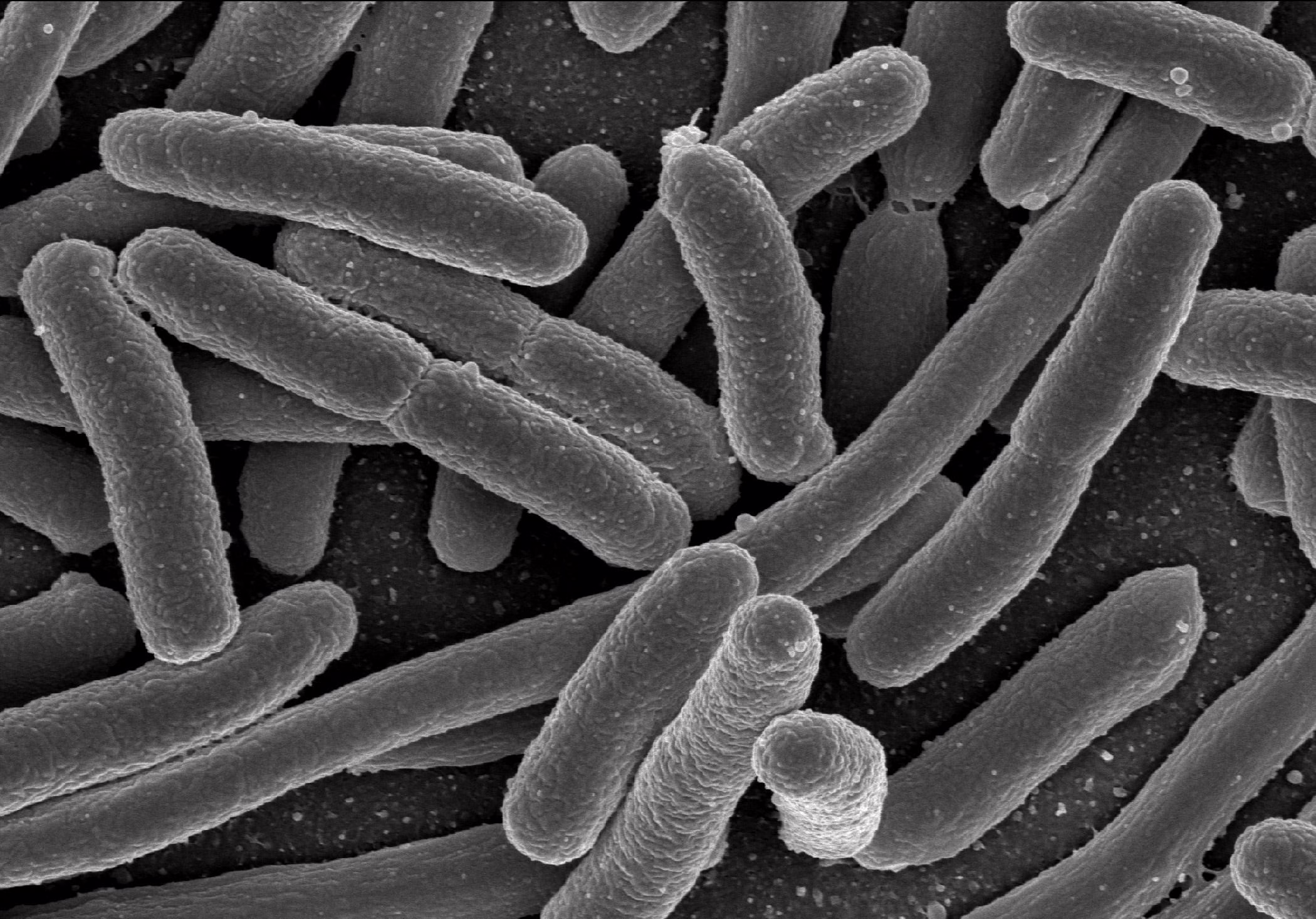 un-estudio-vincula-una-toxina-bacteriana-en-los-ninos-a-la-“epidemia”-de-cancer-colorrectal-en-los-adultos-mas-jovenes
